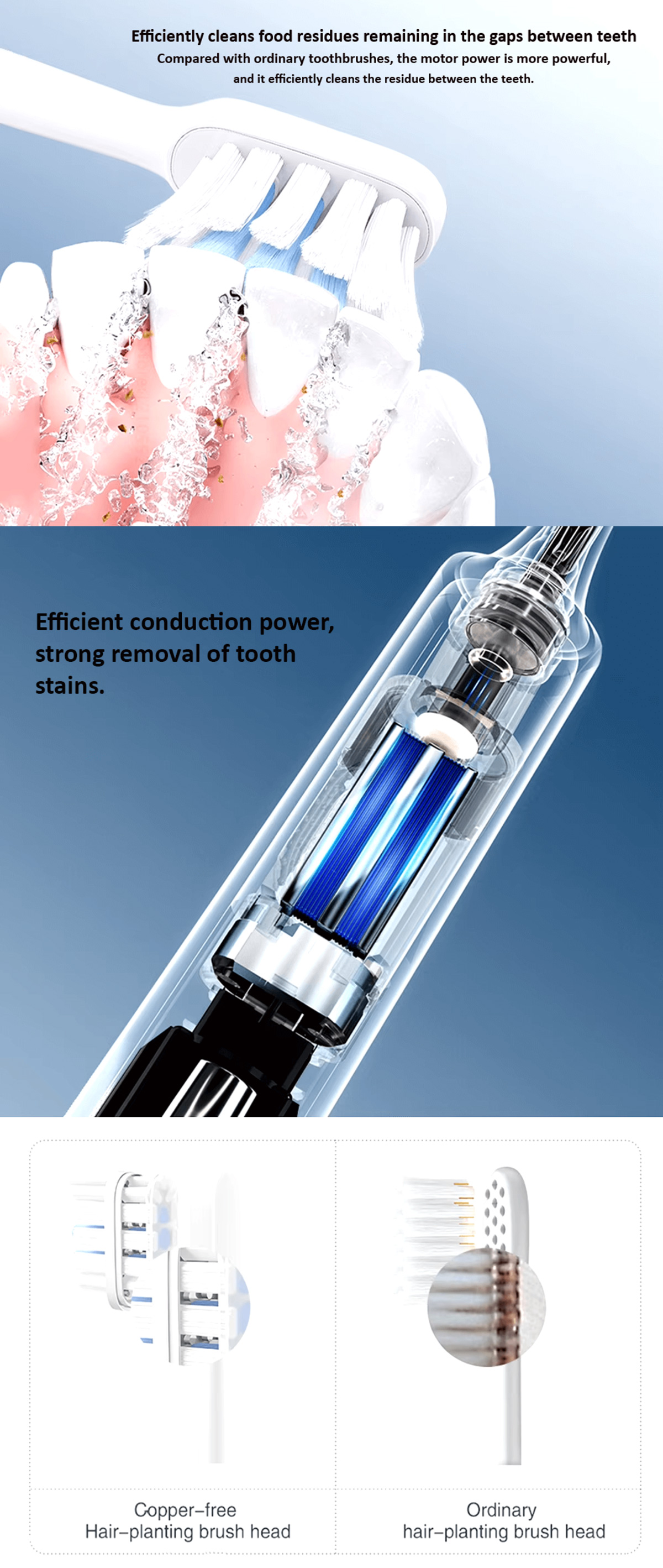 Xiaomi Sonic Electric Toothbrush T301