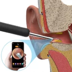Bebird R1 Smart Earwax Removal Tool Camera Endoscope